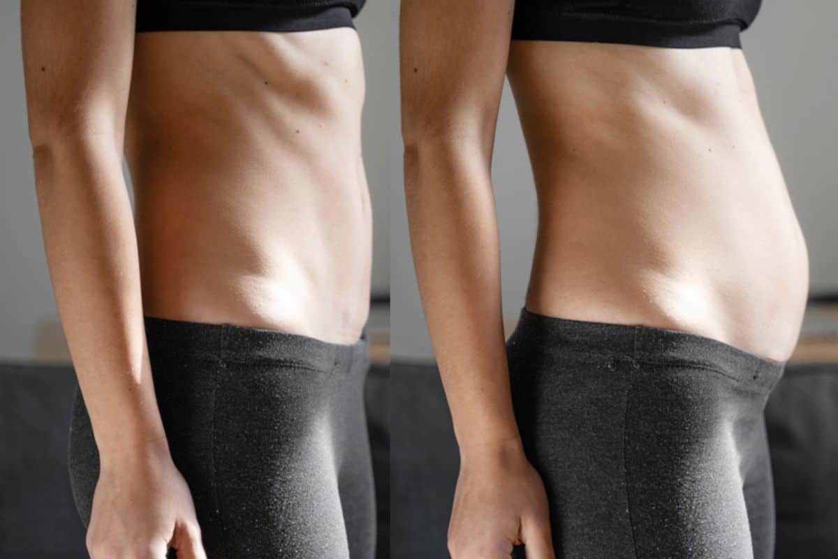 How long does diastasis recti take to improve Prestwich?