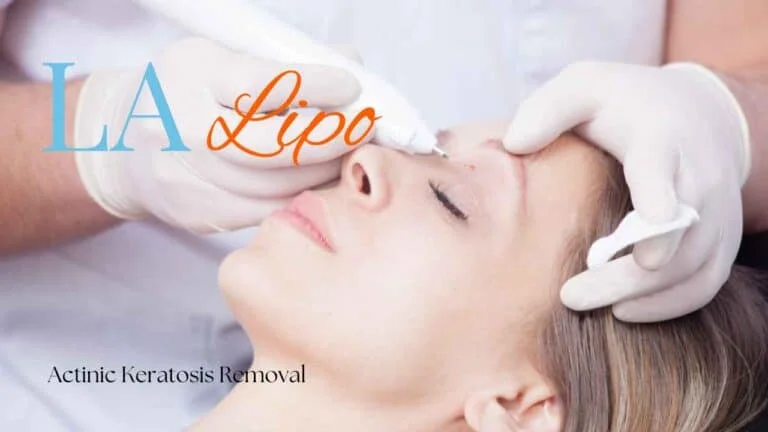 Woman receiving Actinic Keratosis Removal Treatment Prestwich