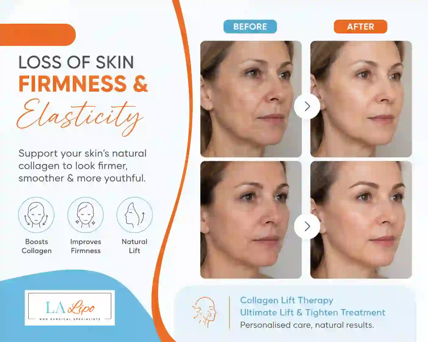 Sign #7: Loss of Skin Firmness and Elasticity Prestwich