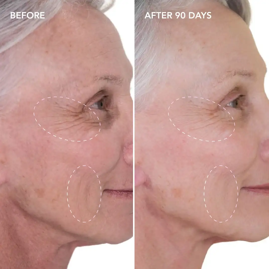 When will you see results Prestwich